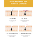 Dr Rashel Hair Removal Cream Legs & Body 5 Min Fast Acting Aloe Vera & Vitamin E 100g