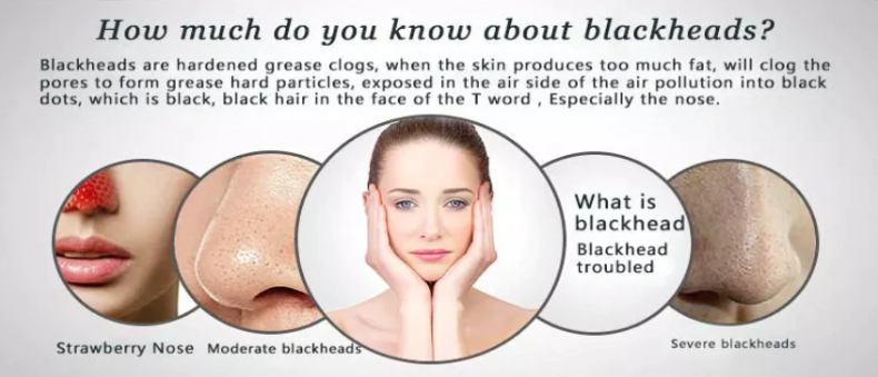 Dr.Rashel Black Peel off Mask Remove Blackheads 120ml